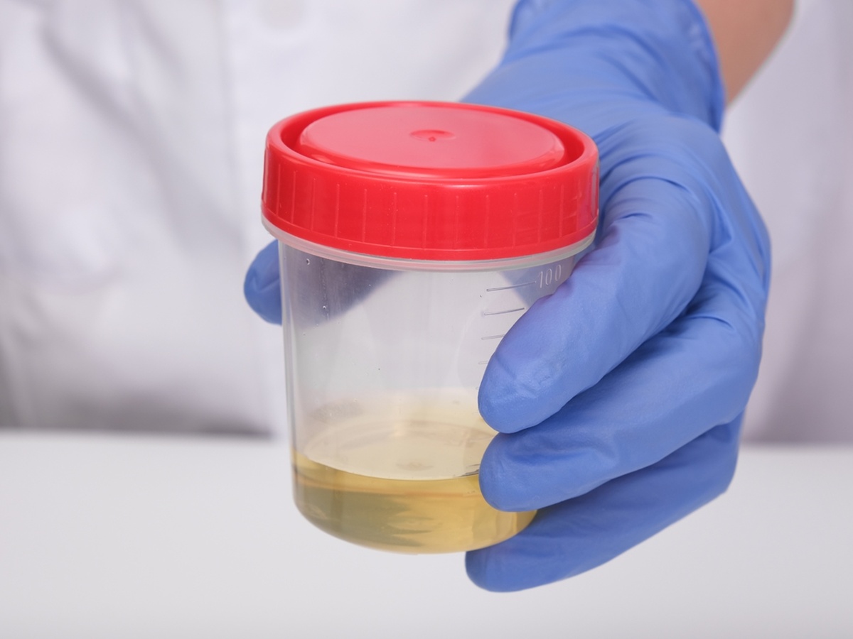 Urine point of care drug test medium