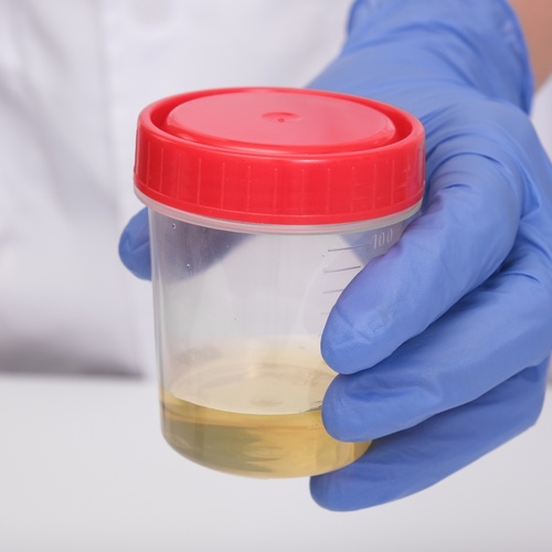 Urine point of care drug test medium