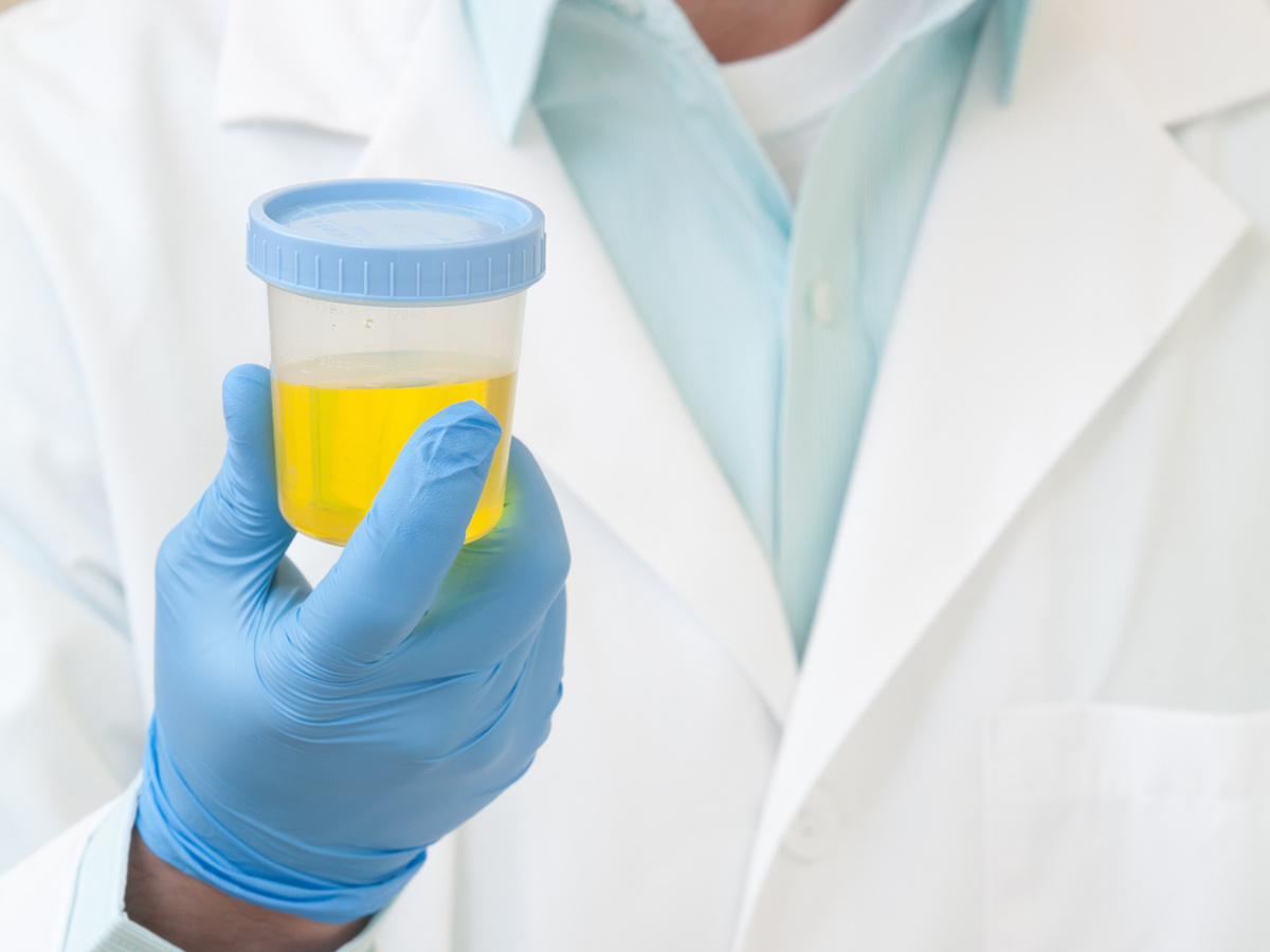 Urine POC drug testing