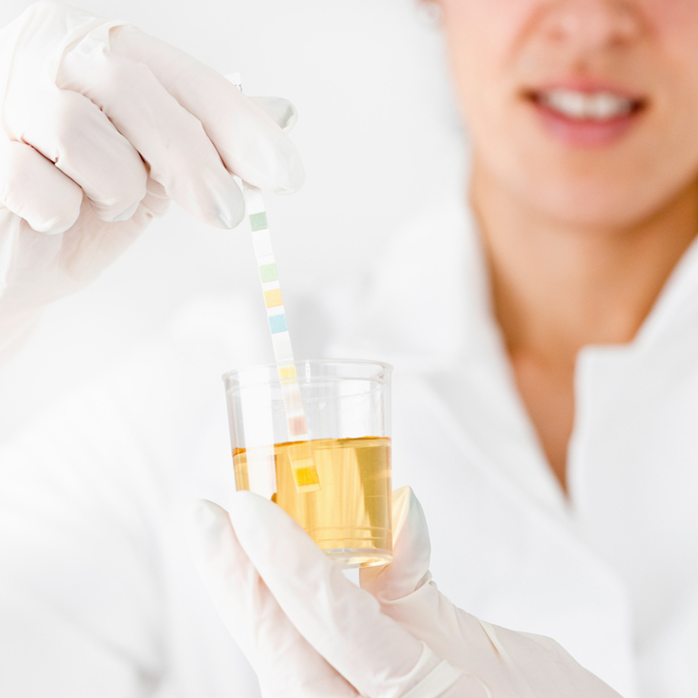 Urine POCT drug testing
